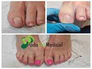 Podo Ped Medical