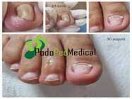 tratamente de pedichiura medicala