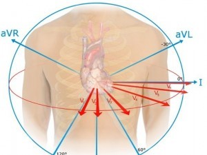 Electrocardiograma - EKG