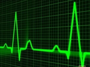 Electrocardiograma - EKG