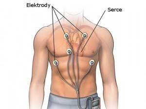 Holter ECG