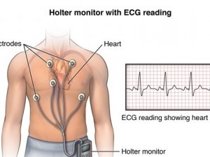Holter ECG